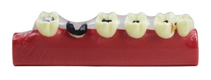 Product List Caries model A4011 back