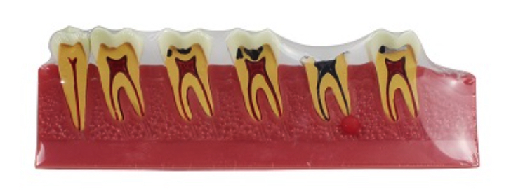 Product List Caries model A4011 front