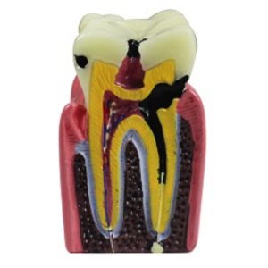 Product List Dental caries demonstration model A4021 back