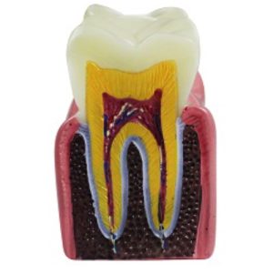 Product List Dental caries demonstration model A4021 front
