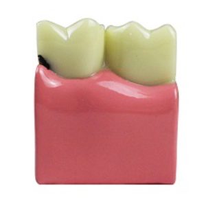 Product List Dental caries demonstration model A4021 side