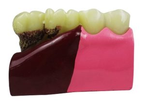 Product List Pathological model A4007 2 back