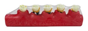 Product List Periodontal disease classification model A4010 back