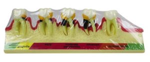 Product List Periodontal disease classification model A4010 front