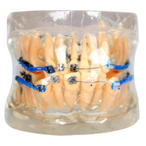 Product List Semi metal and semi ceramic orthodontic model A7006
