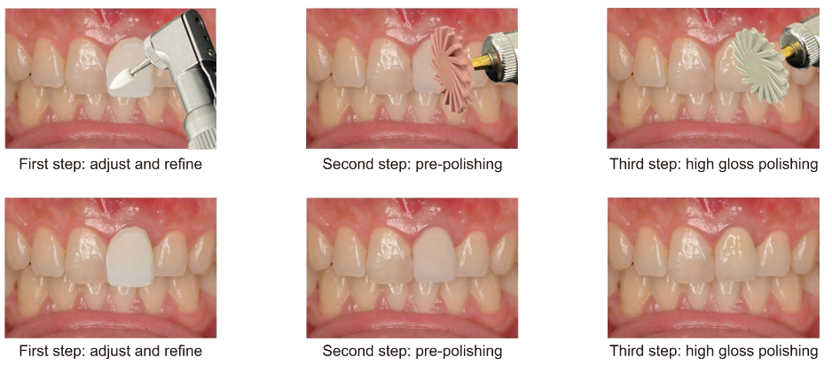 polishing effect comparison